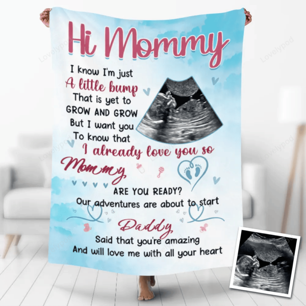 Custom Baby Ultrasound Photo Blankets, Personalized Ultrasound For New Mom Blanket, Happy Mother's Day Blanket, Nursery Gift For her